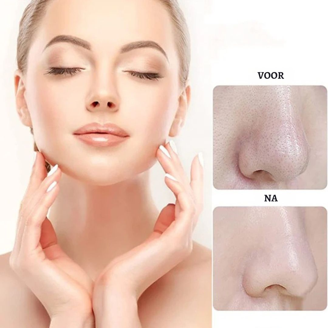 ViyaLix™ | Voor de mooiste huid!