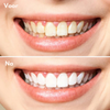 BrightSmile™ | Laat je tanden direct witter stralen