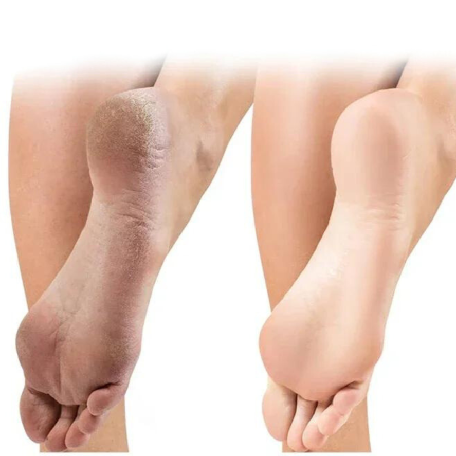 FreshSkin™ | Maak uw huid soepel