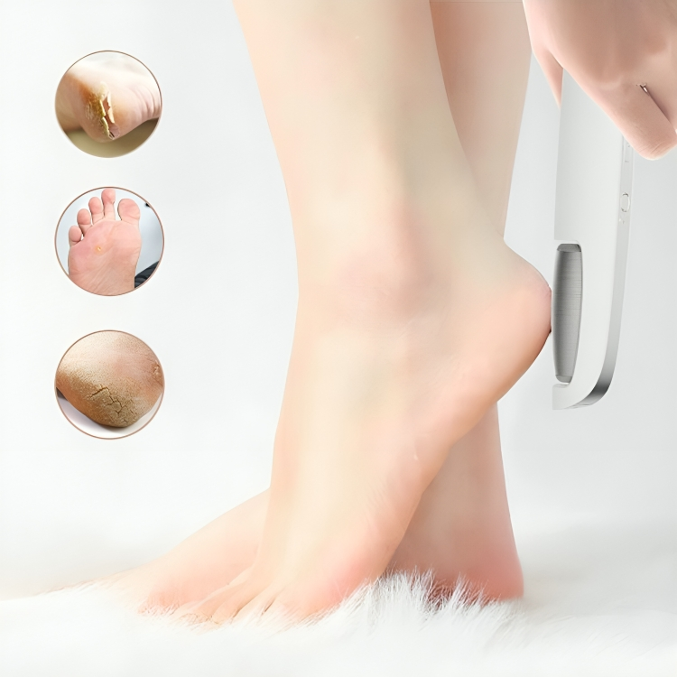 BareLuxe™ | Altijd gladde en gezonde voeten!