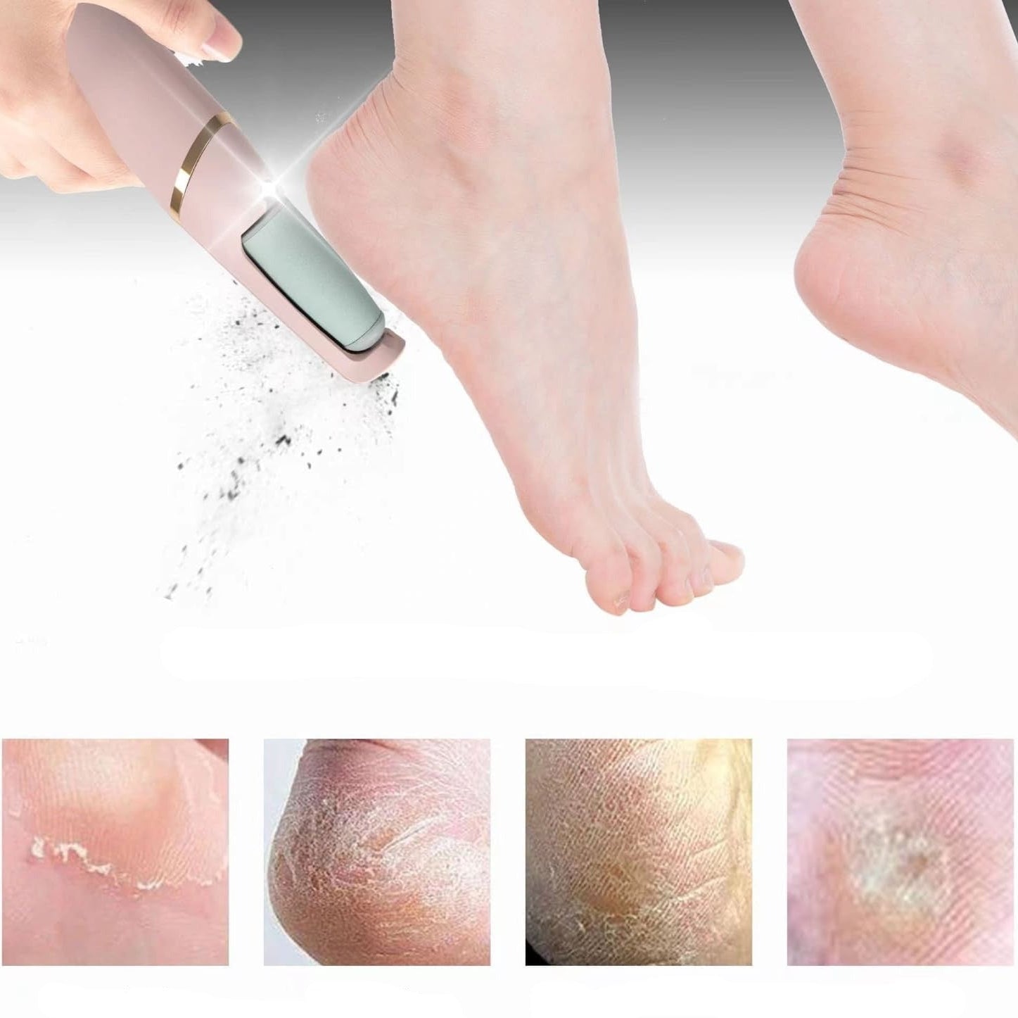 FeetCleanse™ | Altijd zachte voeten