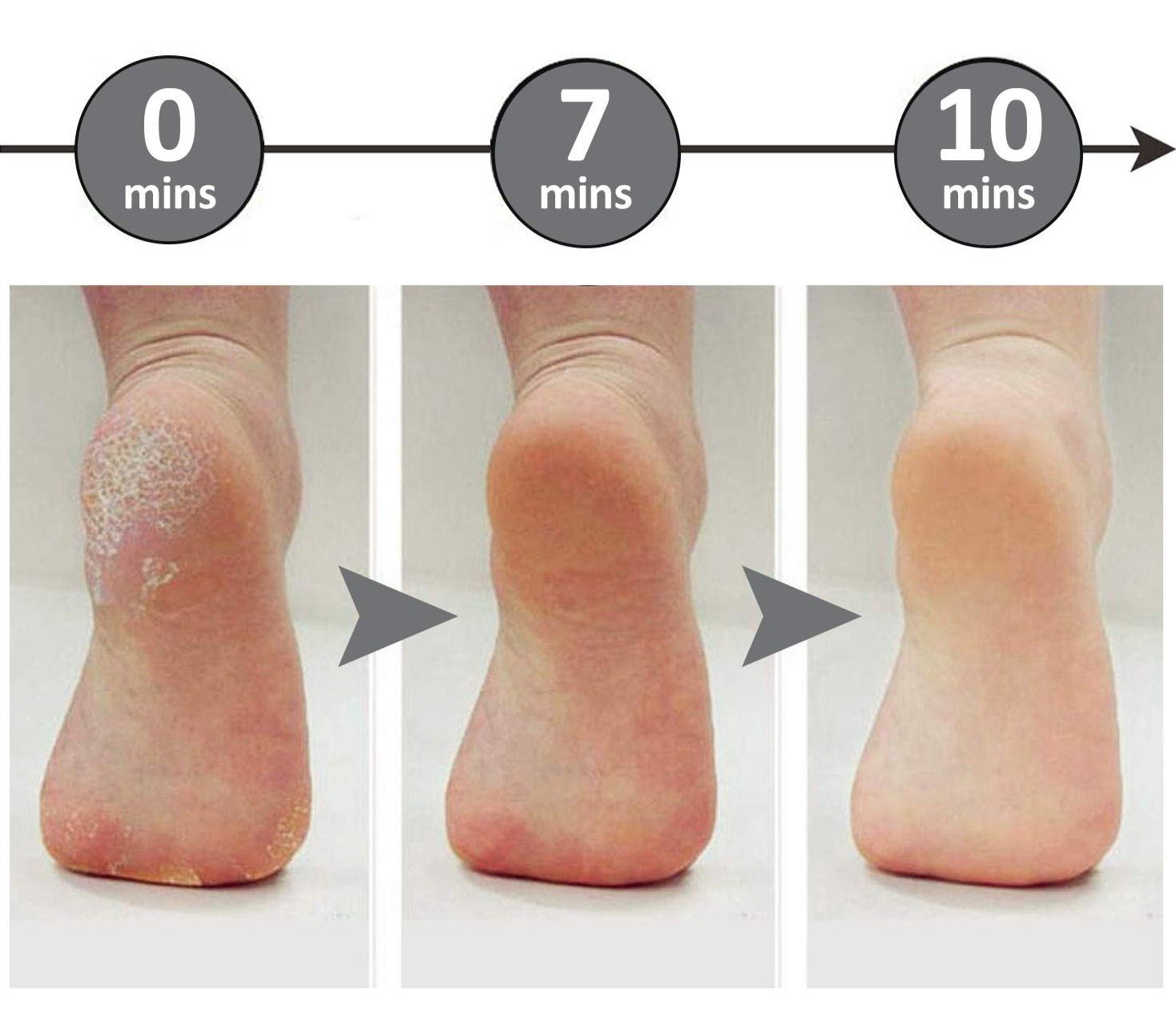 FeetCleanse™ | Altijd zachte voeten